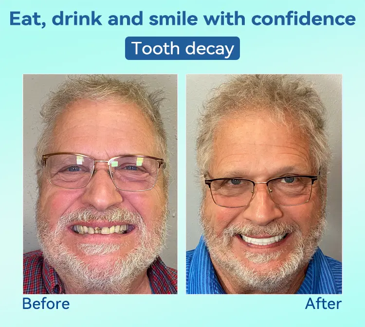 ๐๐๐ซ๐๐ฆ๐ข๐ฎ๐ฆ ๐
๐ฎ๐ฅ๐ฅ ๐๐๐ญ ๐๐๐ง๐ญ๐ฎ๐ซ๐๐ฌ โ ๐๐๐ญ๐ฎ๐ซ๐๐ฅ ๐๐จ๐ฆ๐๐จ๐ซ๐ญ, ๐๐ง๐๐๐๐ญ๐๐๐ฅ๐ ๐
๐ข๐ญ(๐ฆท๐๐ข๐ฆ๐ข๐ญ๐๐ ๐ญ๐ข๐ฆ๐ ๐๐ข๐ฌ๐๐จ๐ฎ๐ง๐ญ ๐๐๐ฌ๐ญ ๐๐ ๐ฆ๐ข๐ง๐ฎ๐ญ๐๐ฌ๐ฆท) - Image 4