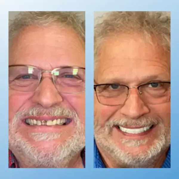 ๐๐๐ป๐ฐ๐๐ถ๐ผ๐ป๐ฎ๐น ๐ง๐ต๐ถ๐ฐ๐ธ๐ฒ๐ป๐ฒ๐ฑ ๐๐ฒ๐ป๐๐๐ฟ๐ฒ๐ - Image 12