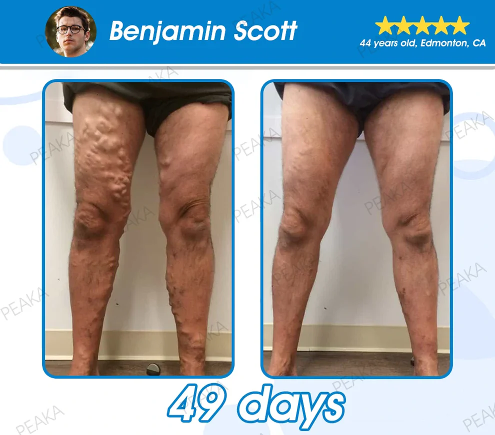 ๐๐ข๐ช๐ฎ๐ข๐ ๐๐๐๐ซ๐ฅ๐ฌ - Image 20