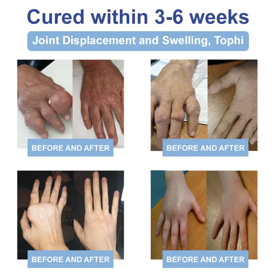 Advanced Magnesium Pain Relief Cream - Image 6