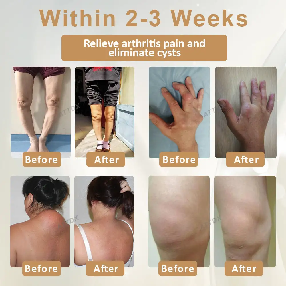 Turmeric Bone Sooth Gel - Image 2