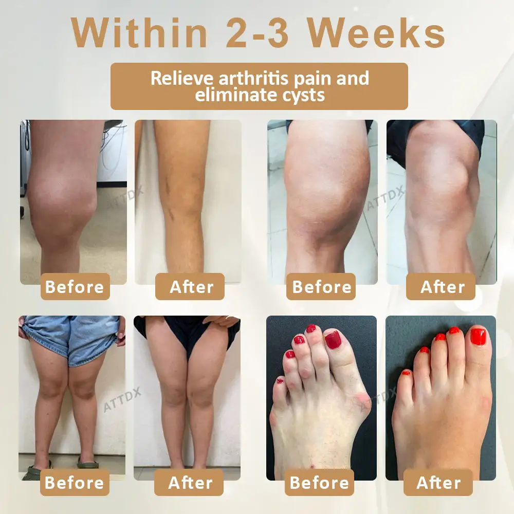 Turmeric Bone Sooth Gel - Image 3