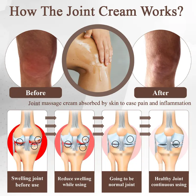 Turmeric Bone Sooth Gel - Image 6