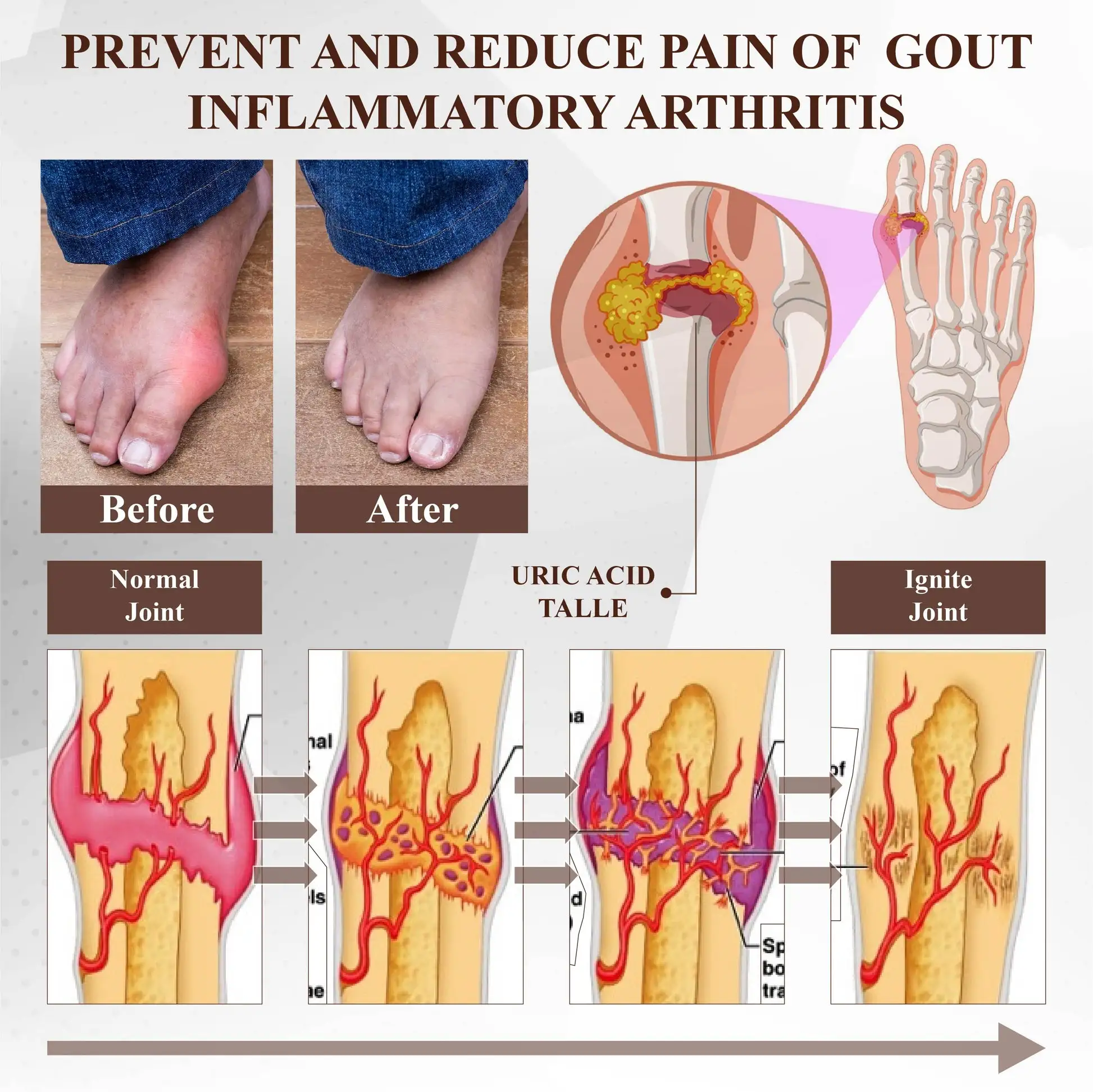 Turmeric Bone Sooth Gel - Image 7