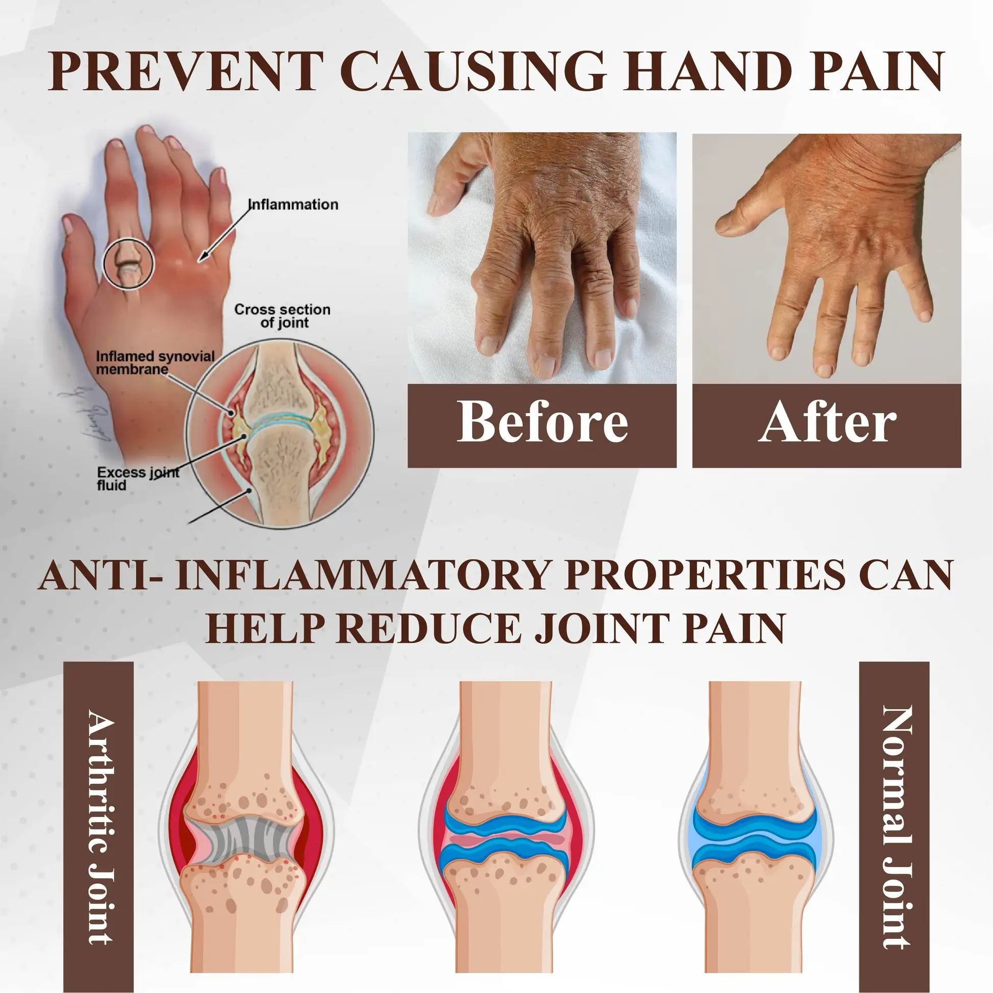 Turmeric Bone Sooth Gel - Image 8