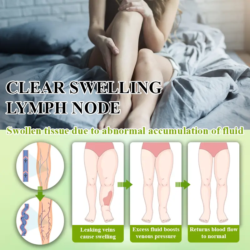 Fluid Regulation Edema Care Cream - Image 9