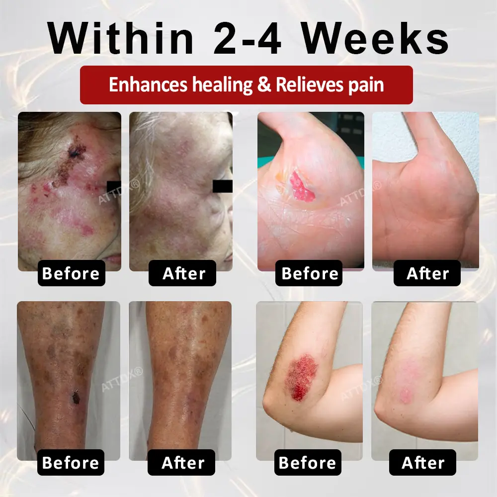 Skin Rescue Cream - Image 7