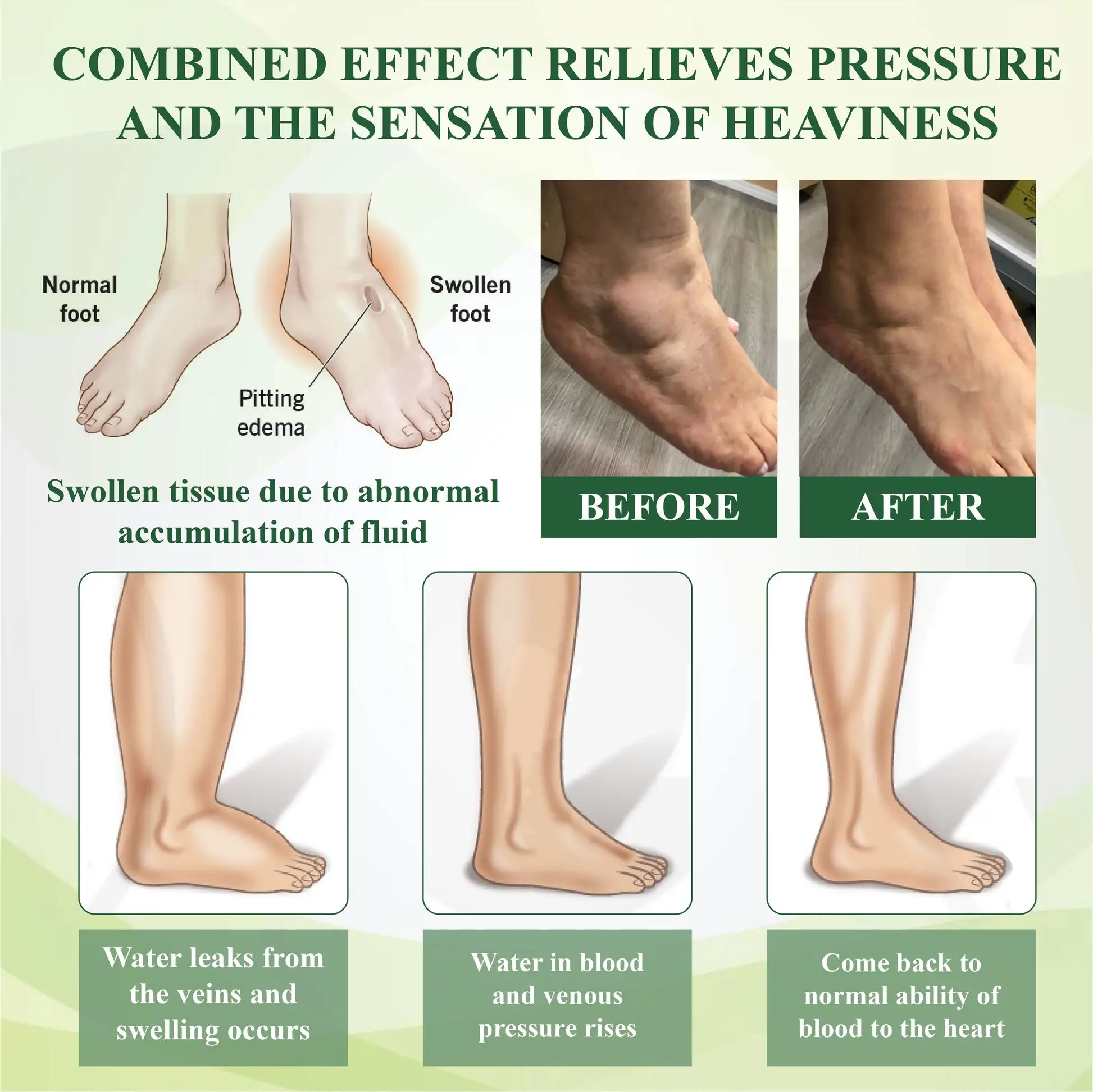 Horse Chestnut Edema Cream - Image 4