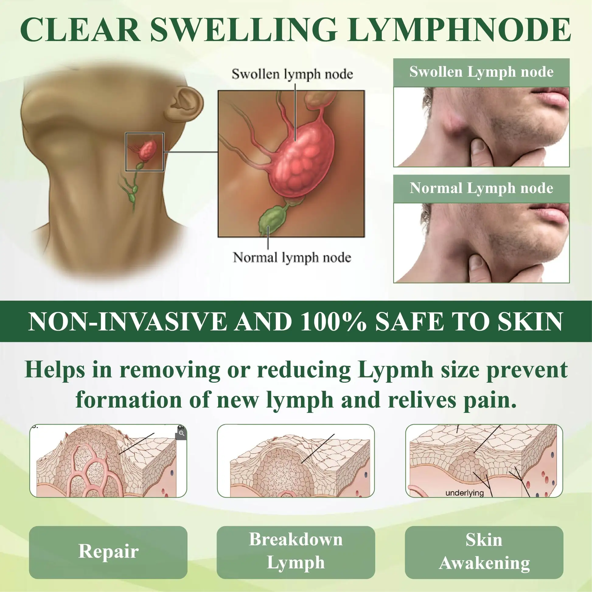 Horse Chestnut Edema Cream - Image 5