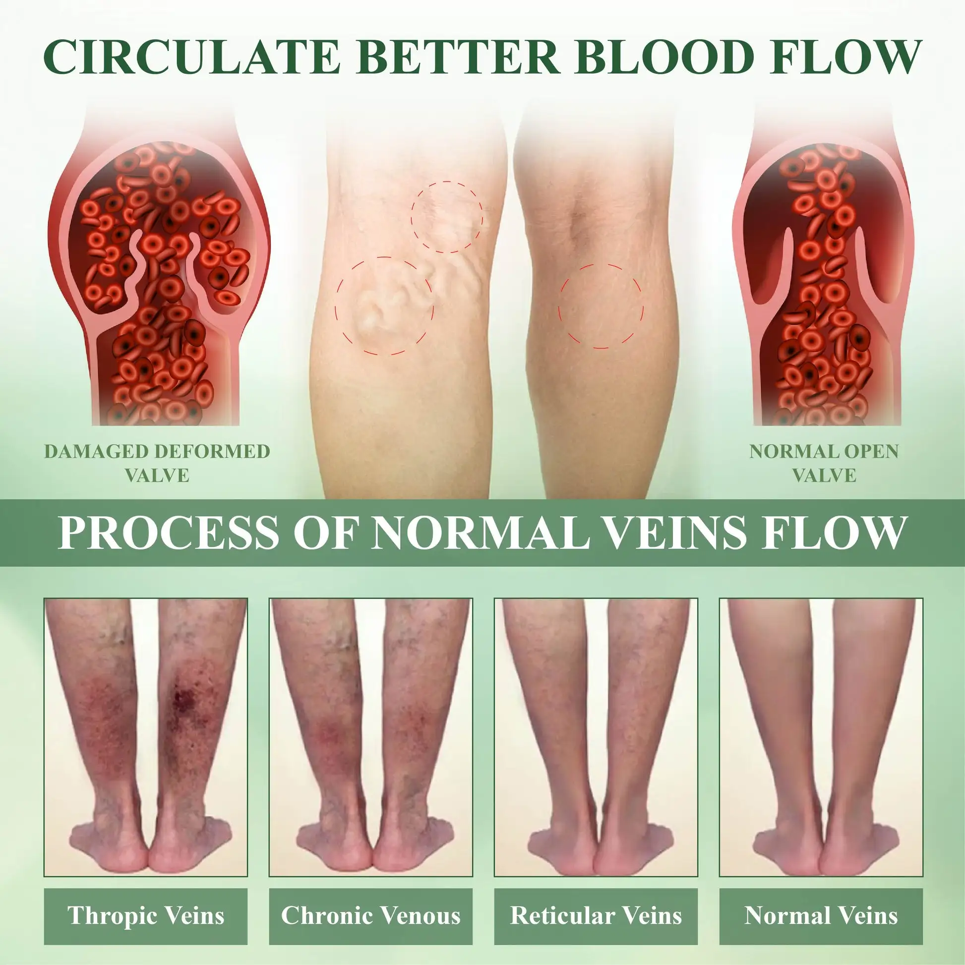 Horse Chestnut Edema Cream - Image 6