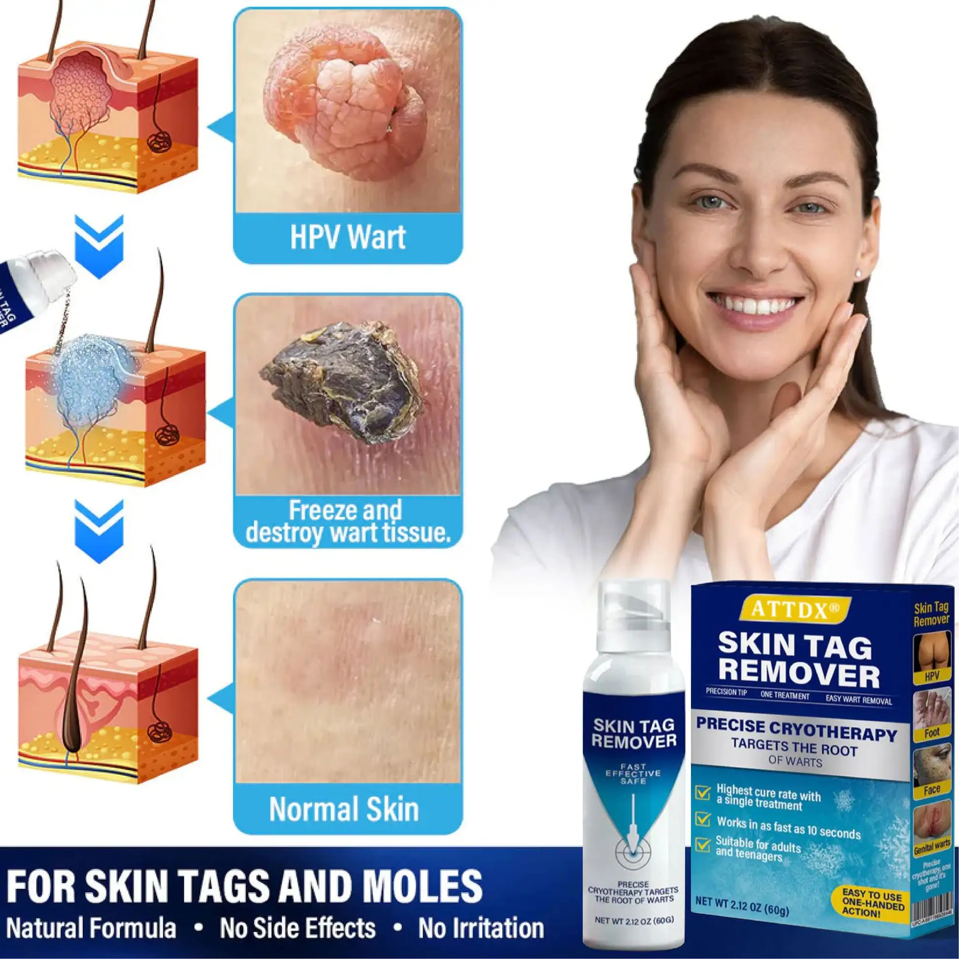 Treatment Spray - Image 2