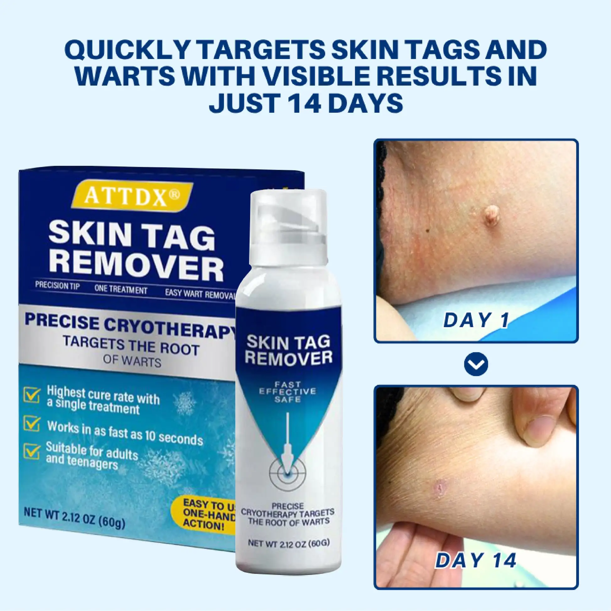 Treatment Spray - Image 4