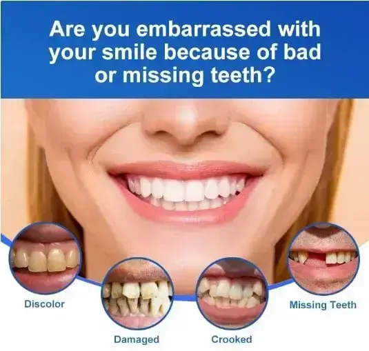 🦷Advanced Customized Full Denture Set🦷 - Image 4
