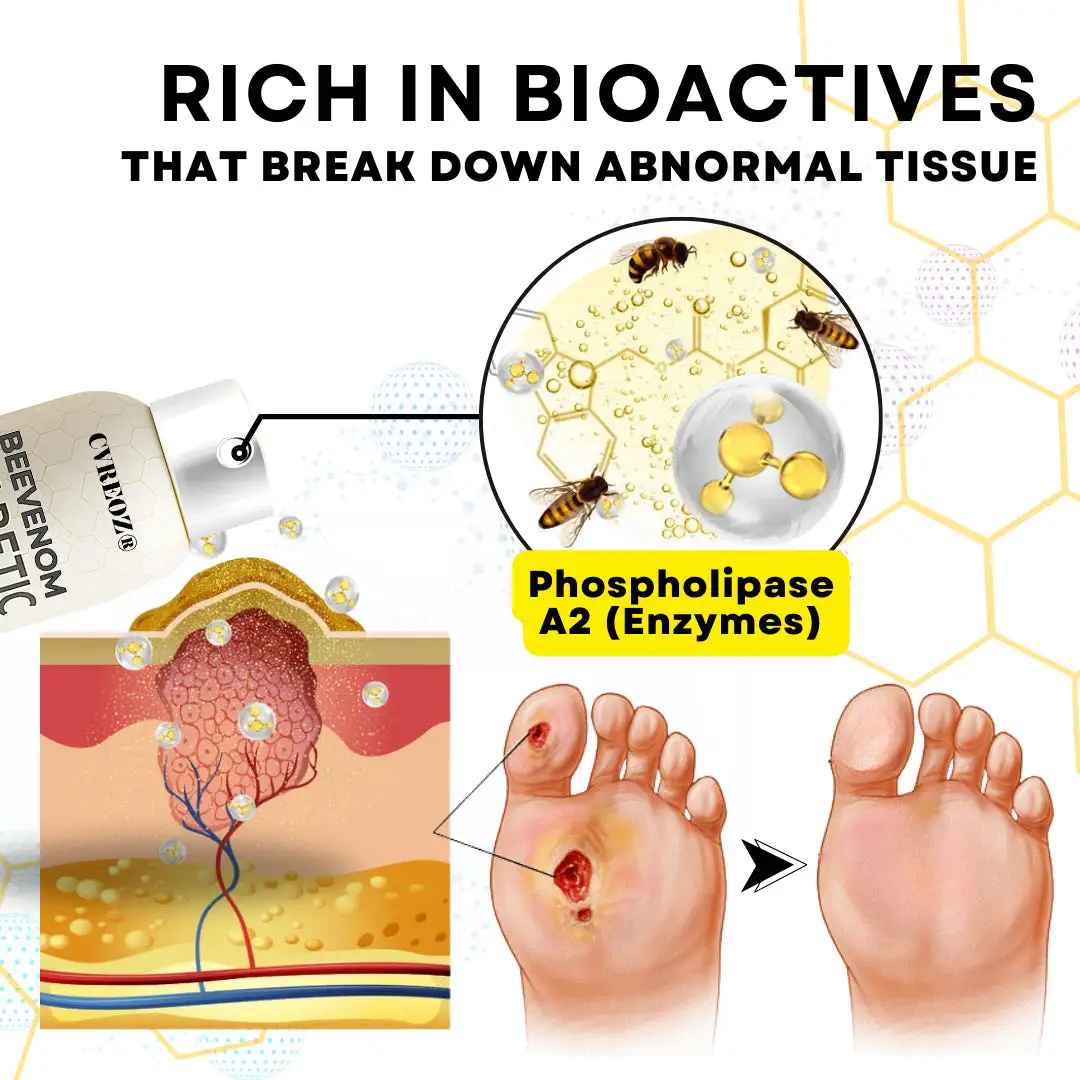 Bee Venom Diabetic Foot Healing Spray - Image 13