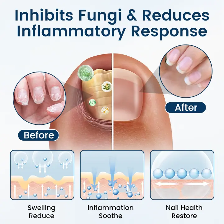 Fungal Repair Herbal Spray - Image 6