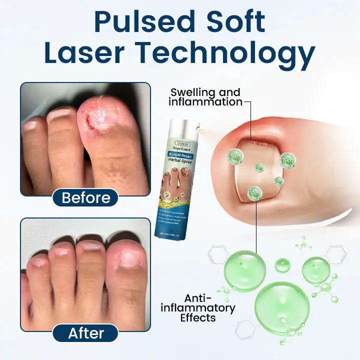 Fungal Repair Herbal Spray - Image 4