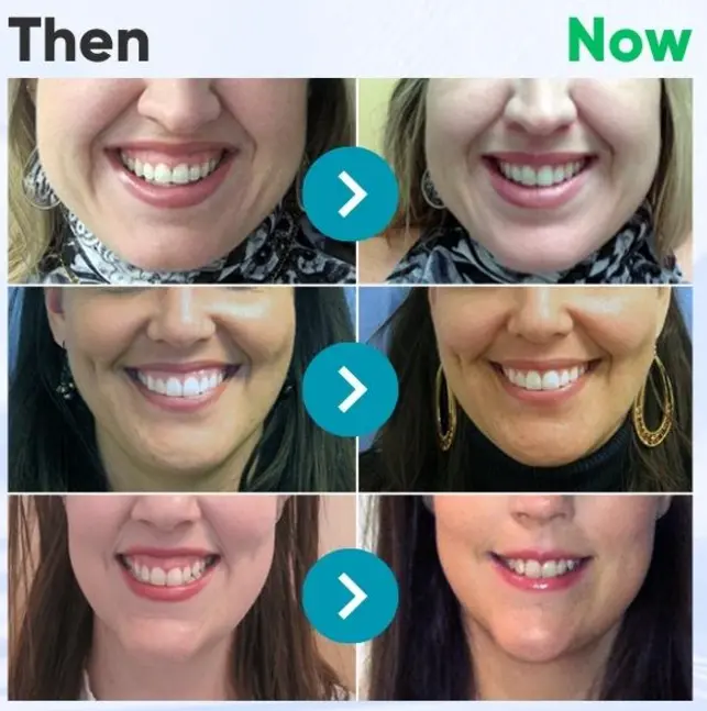 Bee Venom Dental Therapy Oral Power - Image 4