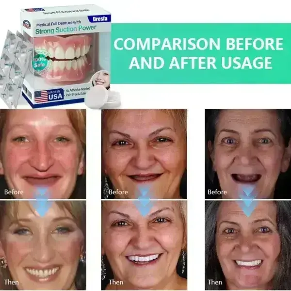 Full Denture with Strong Suction - Image 7