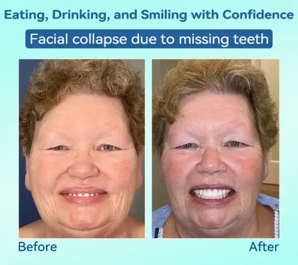 ๐๐๐ซ๐๐ฆ๐ข๐ฎ๐ฆ ๐๐๐ง๐ญ๐ฎ๐ซ๐(๐ฆท๐๐ข๐ฆ๐ข๐ญ๐๐ ๐ญ๐ข๐ฆ๐ ๐๐ข๐ฌ๐๐จ๐ฎ๐ง๐ญ ๐๐๐ฌ๐ญ ๐๐ ๐ฆ๐ข๐ง๐ฎ๐ญ๐๐ฌ๐ฆท) - Image 15