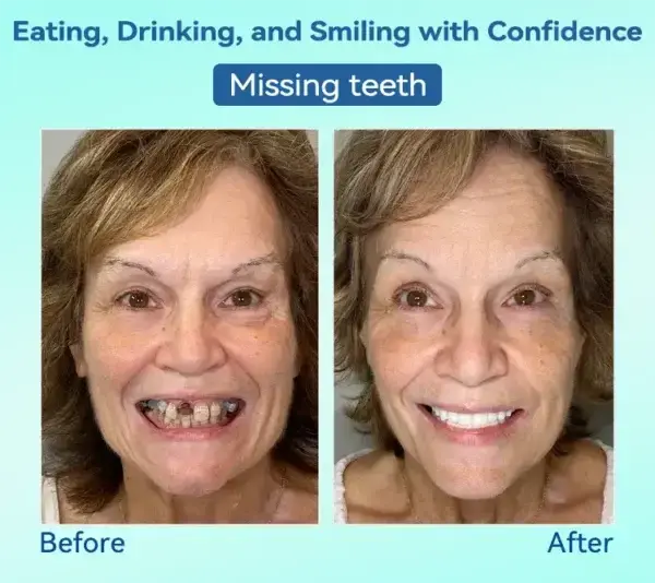 ๐๐๐ซ๐๐ฆ๐ข๐ฎ๐ฆ ๐๐๐ง๐ญ๐ฎ๐ซ๐(๐ฆท๐๐ข๐ฆ๐ข๐ญ๐๐ ๐ญ๐ข๐ฆ๐ ๐๐ข๐ฌ๐๐จ๐ฎ๐ง๐ญ ๐๐๐ฌ๐ญ ๐๐ ๐ฆ๐ข๐ง๐ฎ๐ญ๐๐ฌ๐ฆท) - Image 13