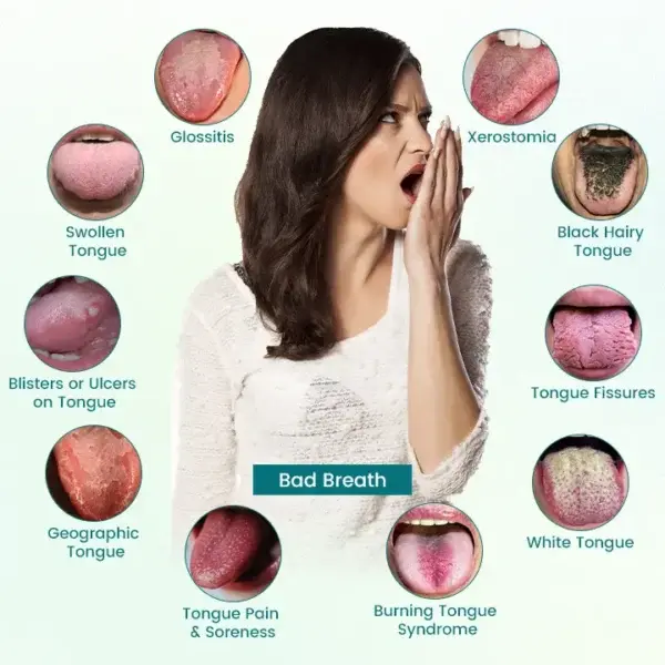 Tongue Repair Spray - Image 7