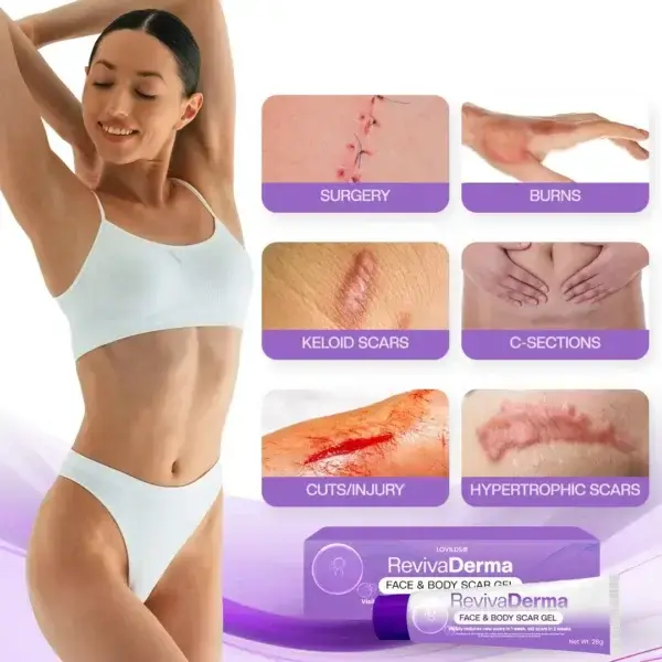 Face & Body Scar Gel - Image 3