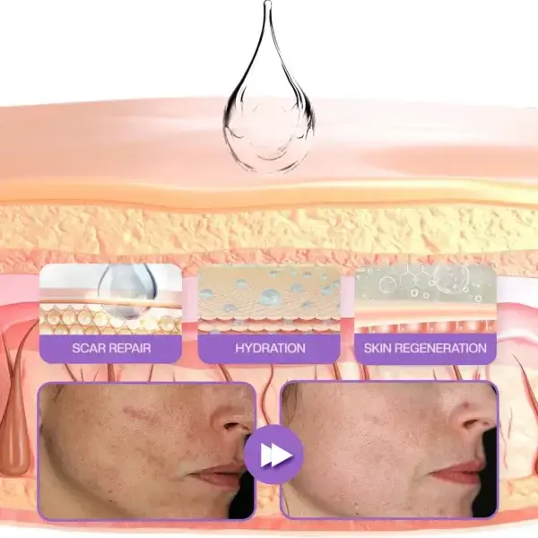 Face & Body Scar Gel - Image 5