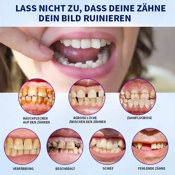 🦷 Fortgeschrittenes, maßgeschneidertes Vollprothesen-Set 🦷 (⏰ Limitierter Rabatt, nur noch 30 Minuten verfügbar ⏰) - Image 10