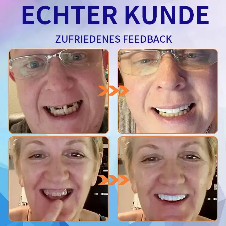 🦷 Fortgeschrittenes, maßgeschneidertes Vollprothesen-Set 🦷 (⏰ Limitierter Rabatt, nur noch 30 Minuten verfügbar ⏰) - Image 9