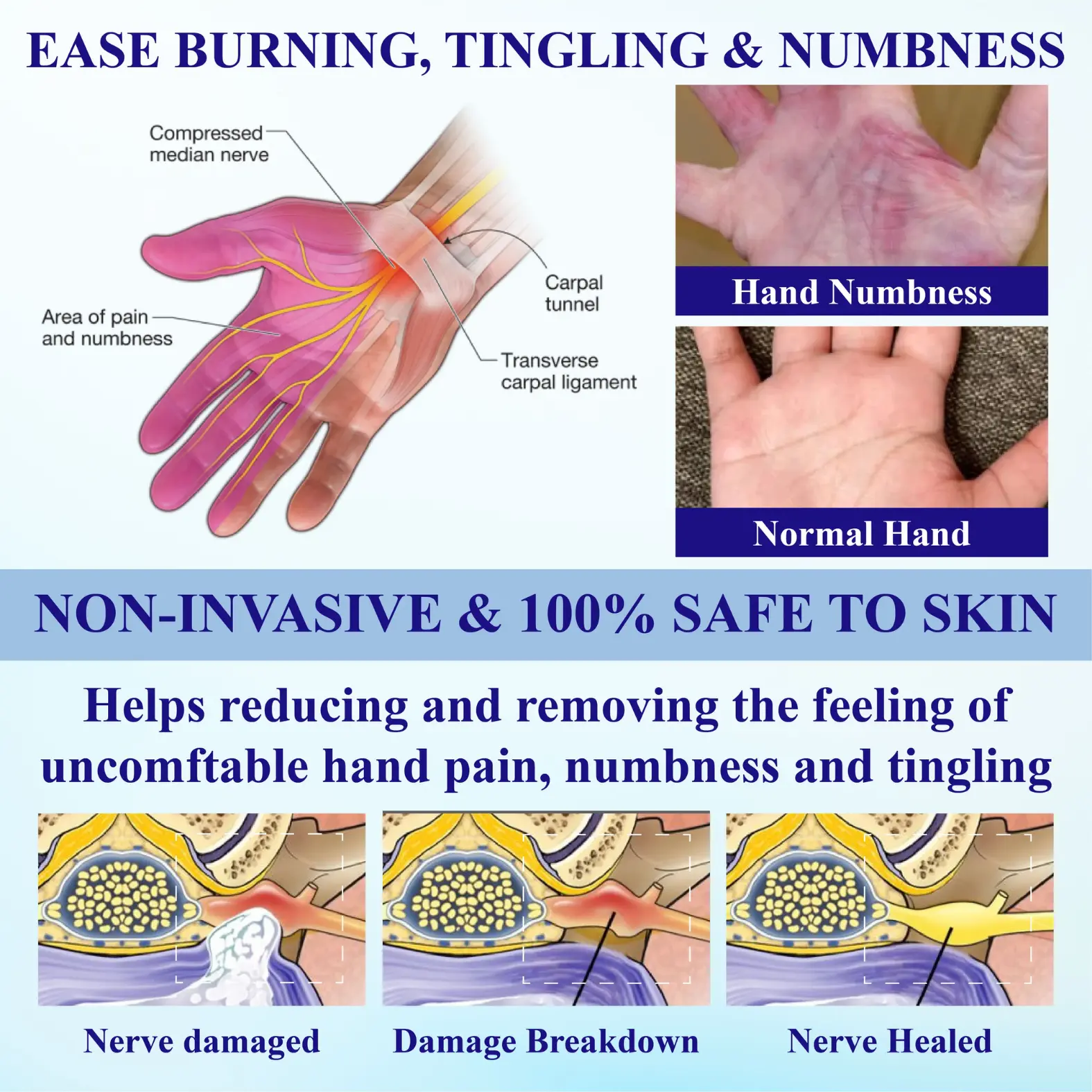 CoolEase Neuropathy Spray - Image 6