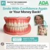 Custom-Fit Full Functional Dentures
