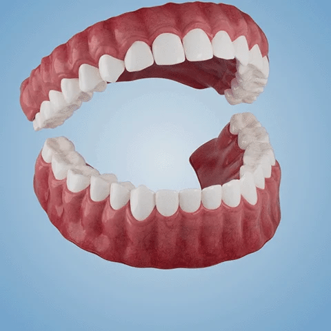 ๐ฑโ๐๐ฆ- ๐๐ซ๐๐ฆ๐ข๐ฎ๐ฆ ๐๐๐ง๐ญ๐ฎ๐ซ๐- (โจSuitable for all mouth shapes, custom-made dentures for a perfect fitโจ๏ผ - Image 5