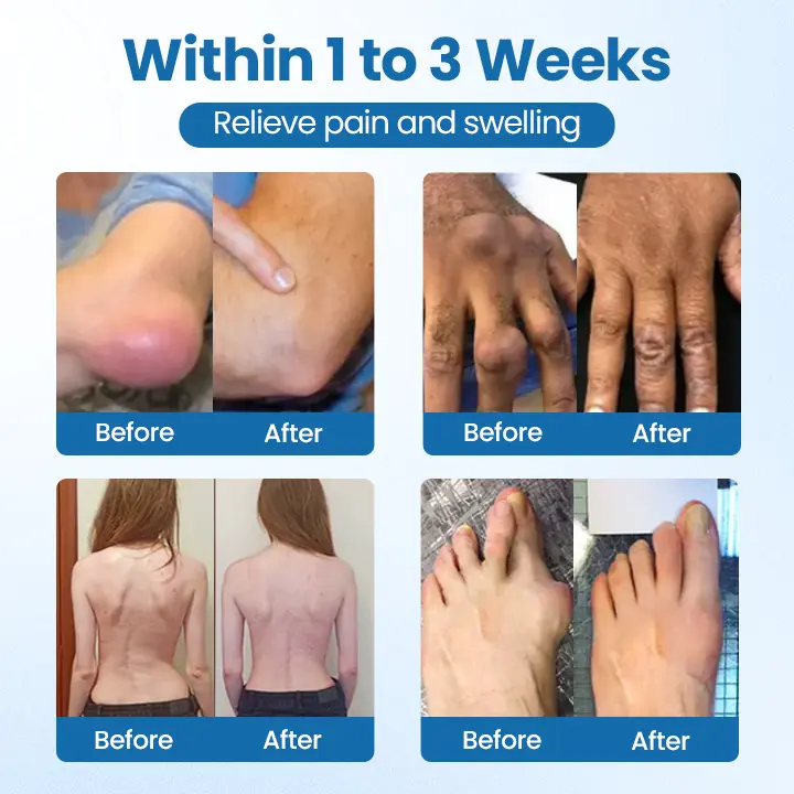 Joint Repair Cream - Image 9