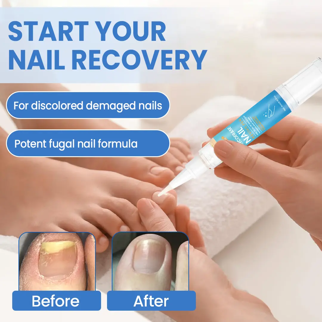 Nail Revive Pen - Image 11
