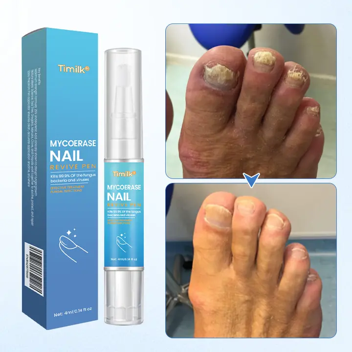 Nail Revive Pen - Image 2