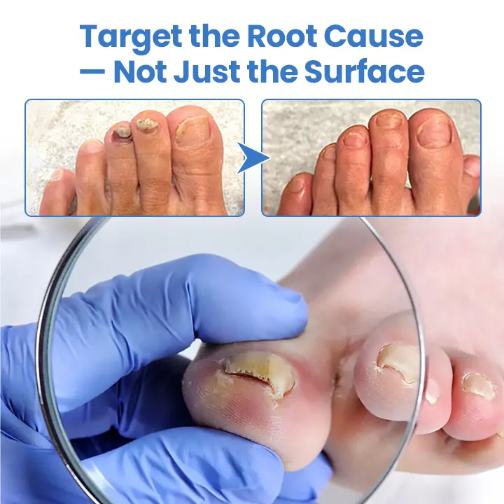 Nail Revive Pen - Image 8