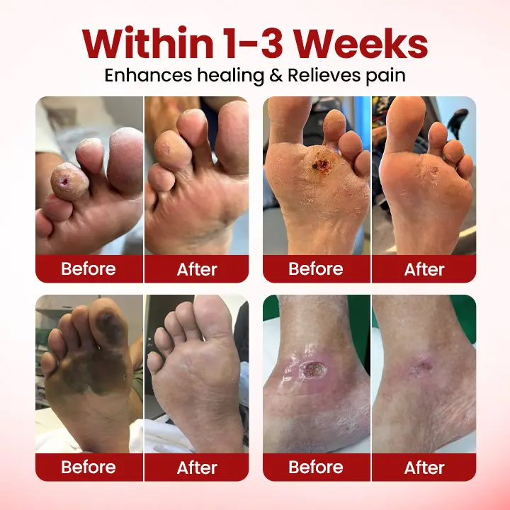 Diabetic Care Cream - Image 4