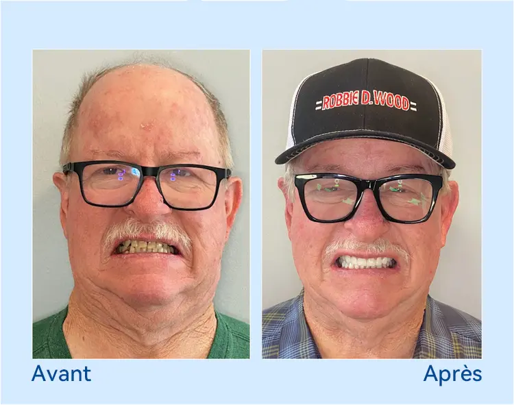 🚀𝐏𝐫𝐨𝐭𝐡è𝐬𝐞 𝐃𝐞𝐧𝐭𝐚𝐢𝐫𝐞 𝐏𝐫𝐞𝐦𝐢𝐮𝐦 (⏰Remise à durée limitée : 30 dernières minutes⏰) - Image 8