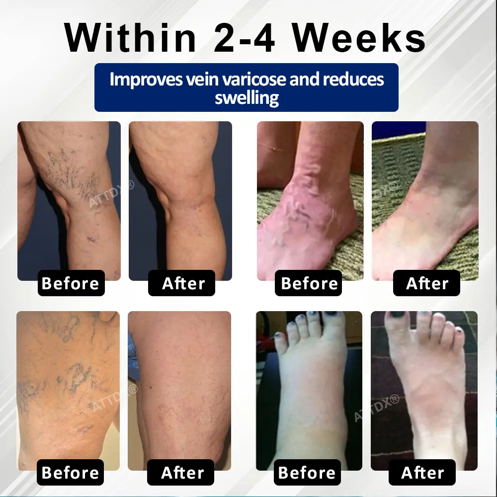 Microneedle Leg Patch - Image 9