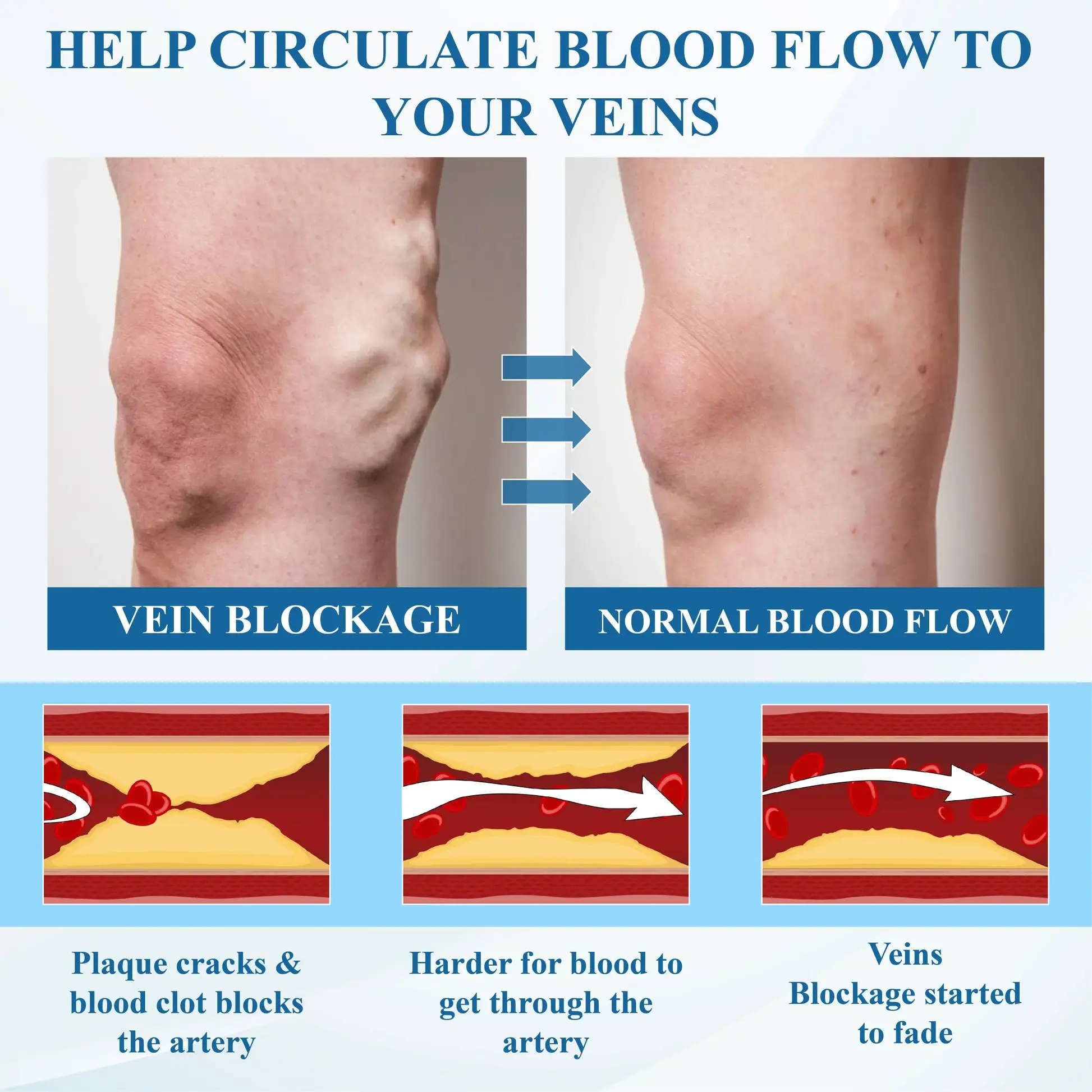Microneedle Leg Patch - Image 13