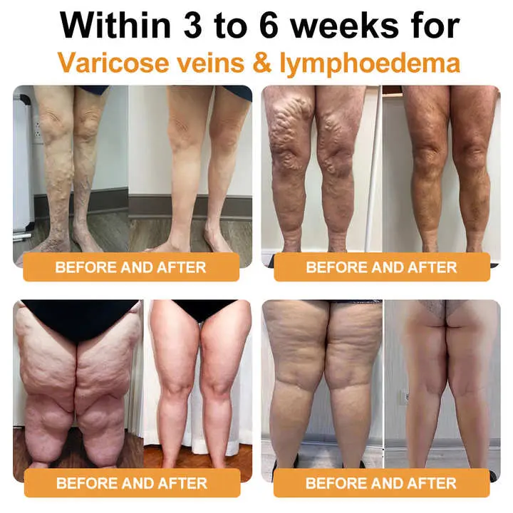 🐝 Detox While You Sleep — Naturally with Bee Toxin 👣 - Image 7