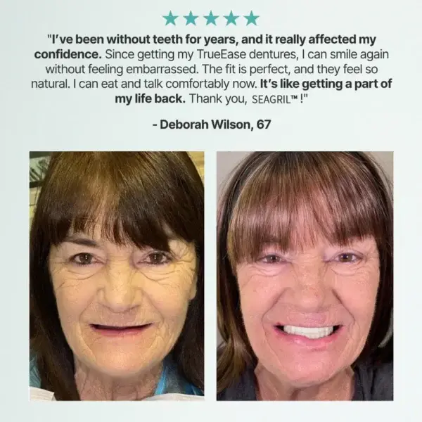 Custom-Fit Full Functional Dentures - Image 4