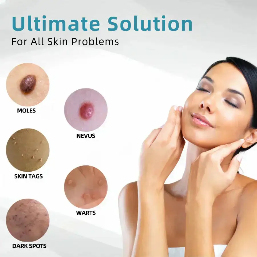 VelvetSkin+ All-in-One Laser Eraser Pen - Image 6