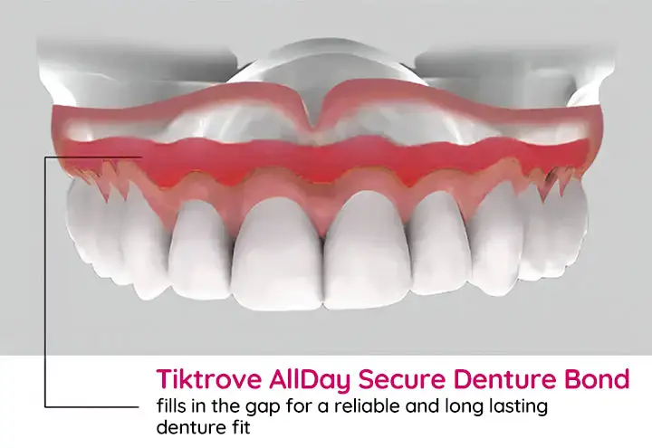 TIKTROVE AllDay Secure Denture Bond - Image 7
