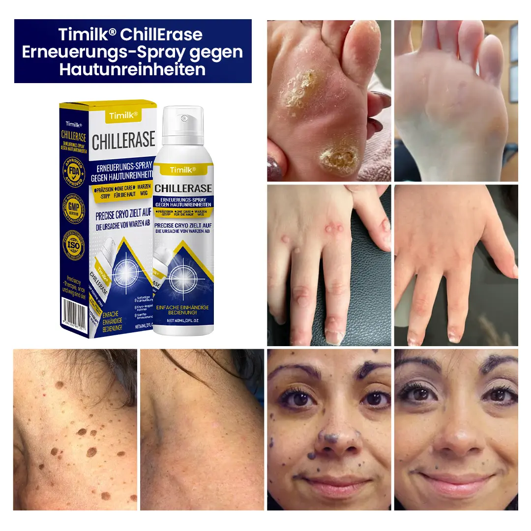 Spray gegen Hautunreinheiten - Image 4