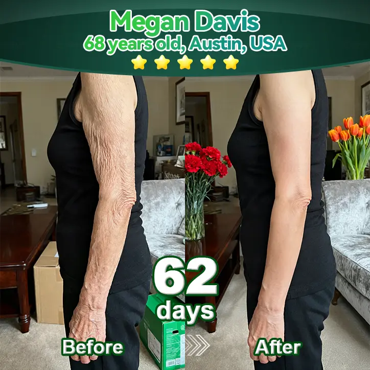 ๐ฆ๐๐ฒ๐บ ๐๐ฒ๐น๐นโ๐๐ฐ๐๐ถ๐๐ฎ๐๐ฒ๐ฑ ๐๐ผ๐น๐น๐ฎ๐ด๐ฒ๐ป ๐ฃ๐ฒ๐ฝ๐๐ถ๐ฑ๐ฒ ๐ฑ๐ฟ๐ผ๐ฝ๐ - Image 12