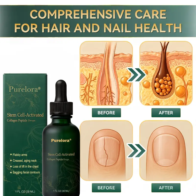 ๐ฆ๐๐ฒ๐บ ๐๐ฒ๐น๐นโ๐๐ฐ๐๐ถ๐๐ฎ๐๐ฒ๐ฑ ๐๐ผ๐น๐น๐ฎ๐ด๐ฒ๐ป ๐ฃ๐ฒ๐ฝ๐๐ถ๐ฑ๐ฒ ๐ฑ๐ฟ๐ผ๐ฝ๐ - Image 3