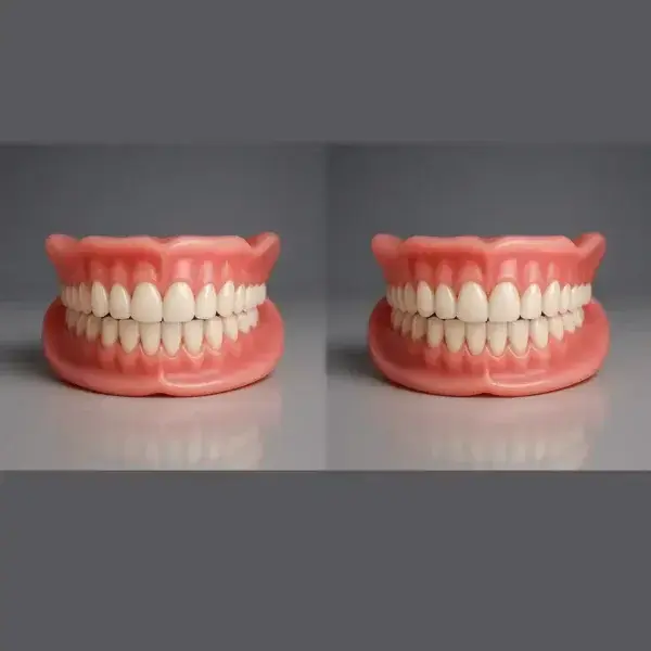 Custom-Fit Functional Dentures – Perfectly Fitted in Minutes at Home - Image 4