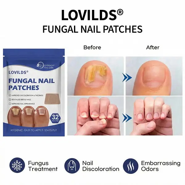 FUNGAL NAIL PATCHES - Image 3